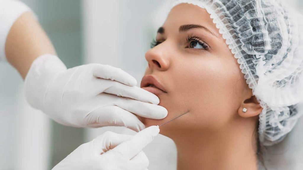 Why Thread Lifts Are the Go-To Lunch-Time Face Lift